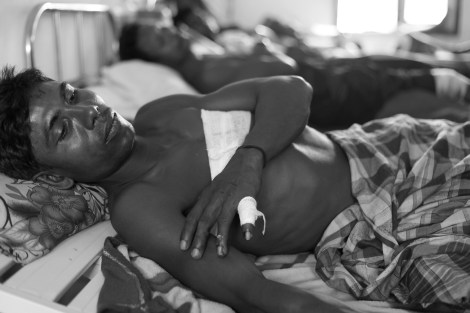 8월 9일 시뜨웨 외곽 로힝야/무슬림 피난민(IDPs)캠프에서 경찰의 발포로 부상입은 이가 캠프안 다파잉 클리닉에 누워있다. 캠프와 인근 무슬림 마을내 치안담당으로 주둔하는 경찰 일부가 전 국경경찰 나사까 (Nasaka) 출신인 것으로 알려져 있다. 로힝야 무슬림들은 버마 군인보다 나사까를 더 두려워한다. (Photo © Lee Yu Kyung 2013) 