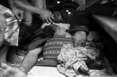 8월 9일 시뜨웨 외곽 로힝야/무슬림 피난민(IDPs)캠프에서 경찰의 발포로 다리에 부상입은 이가 캠프안 다파잉 클리닉 뜰에 주차된 트럭안에 누워있다. (Photo © Lee Yu Kyung 2013) 