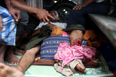 8월 9일 시뜨웨 외곽에 위치한 로힝자/무슬림 난민 캠프에서 경찰의 발포로 최소 2-3명이 사망하고 10여명이 부상을 입었다. 병원 뜰에 주차된 한 트럭에는 다리에 총상을 입은 환자가 속수무책으로 누워 있었다. (Photo © Lee Yu Kyung) 