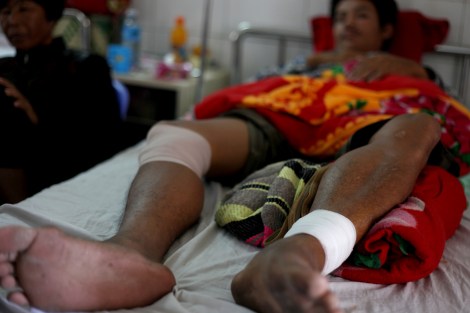 Srey Thorn (24) was driving Tuk Tuk on January 3rd when he got shot with 3 bullets near Canadia Industrial Park on Veng Sreng road. On that day tens of thousands garment workers were demand wage raise from 80 USD to 160 USD per month. According to workers who participated in the strike, most of workers from the Industrial Park had participated as they were outraged by the violent crackdown on previous day. (Photo © Lee Yu Kyung)