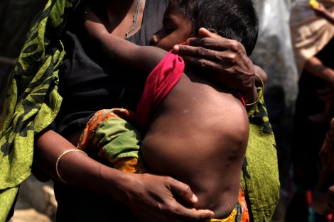 같은 캠프에 사는 4살 소년 소메야딴은 꼽추로 태어나 사고까지 만난 뒤 늘 숨을 가쁘게 몰아쉰다. NGO가 운영하는 캠프 내 병원에서 기본적인 의료 지원만 가능할 뿐 질병 ‘치료’ 같은 건 꿈도 못 꾼다. (Photo © Lee Yu Kyung)