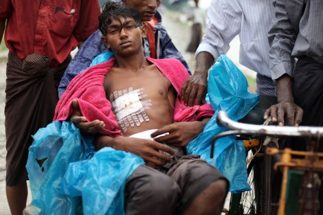 시트웨_로힝야_경찰총격부상_치료불가_사진_이유경_2013