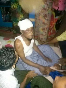 우라뮌_7.4공격으로 머리부상_사진제공_로힝야주민_01